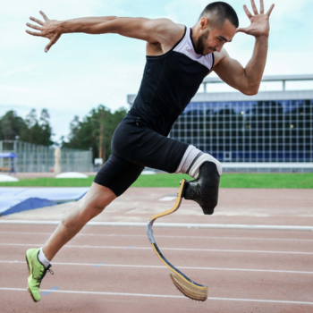 Below  Knee Prosthesis