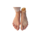 Functional Prosthetic Silicone Foot