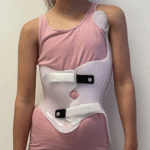 Scoliosis Brace (3)