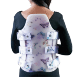 Scoliosis Brace (3)