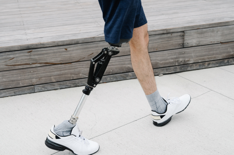 prosthetic limb